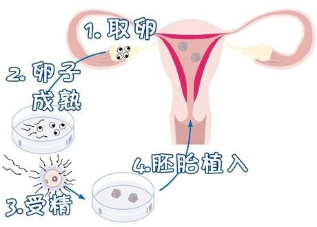 方鉴生殖医学中心