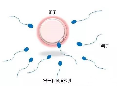 42岁二胎